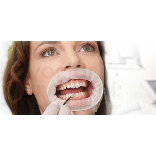 20pcs/Lot Dental Ivoclar Vivadent Mouth Opener Optragate 3D Lip Cheek Retarctor Refill