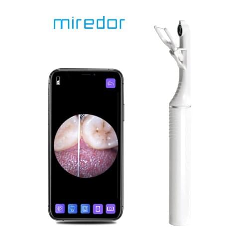Miredor Intelligent Vision Dental Floss,Visualization Care Teeth Cleaner With Free 50 Replaceable Floss & 20 Cleaning Cotton Pad