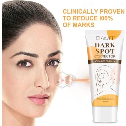 Face Concealer Dark Spots Freckle Cream Brightening Facial Skin Corrector Cream 80g Repair Fade Freckles Melasma Remove Pigment