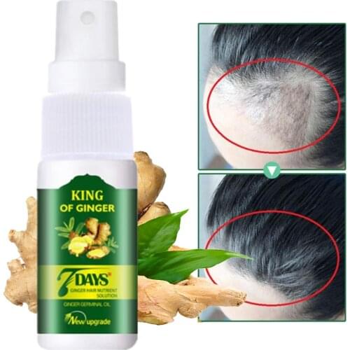30ML Ginger Hair Growth Essence Spray Germinal Hair Growth Serum Essence Oil Hair Loss Treatment For Men And Women