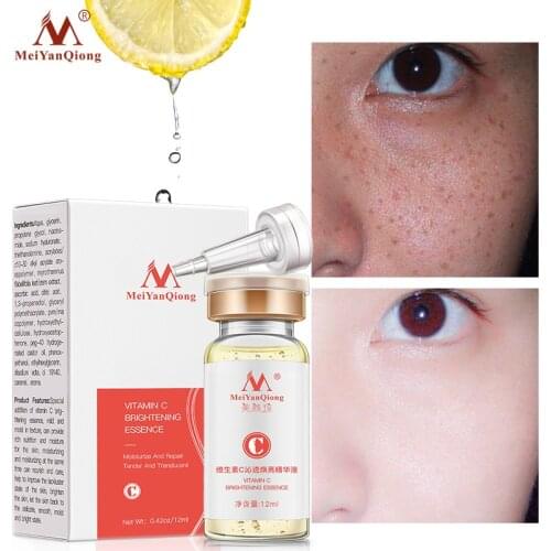 MeiYanQiong VC Serum Hyaluronic Acid Face Cream Snail Remover Freckle Speckle Fade Dark Spots Anti-Aging Whitening Skin Care