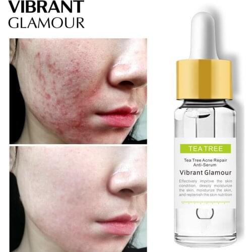 VIBRANT GLAMOUR Tea Tree Acne Face Serum Repair Scar Acne Treatment Oil Control Anti Acne Marks For Sensitive Skin Care Essence