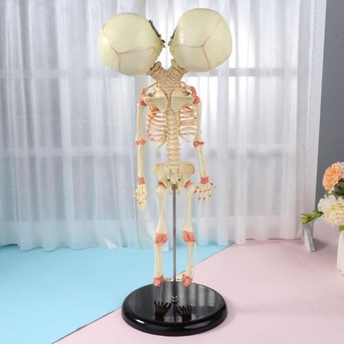 37cm Human Double Head Baby Skull Skeleton Anatomy Brain Display Study Teaching Anatomical Model Dropship