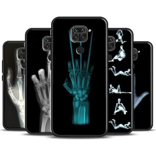 X-ray Hand Bones Cover For Xiaomi Redmi Note 9 Pro 7 8 8T 9S Note 10 Pro Phone Case For Redmi K40 9A 9C 9T