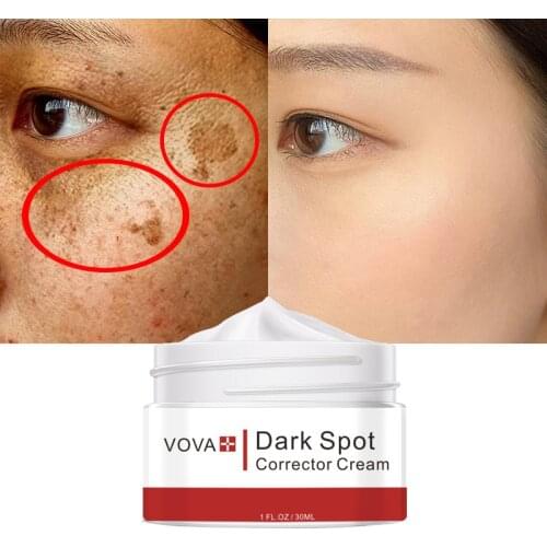VOVA Dark Spot Corrector Cream Remove Melasma Acne Spot Pigment Melanin Dark Spots Pigmentation Freckle Removal Whitening Cream