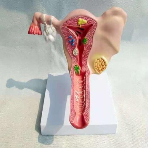 Female reproductive uterus Vagina and ovary Anatomical and pathological model Gynecological reproductive teaching aids
