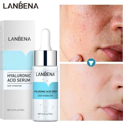 LANBENA Hyaluronic Acid Serum Moisturizing Nourshing Whitening Dull Skin Oil Control Pores Corset Brighten Face Tone Anti-Aging