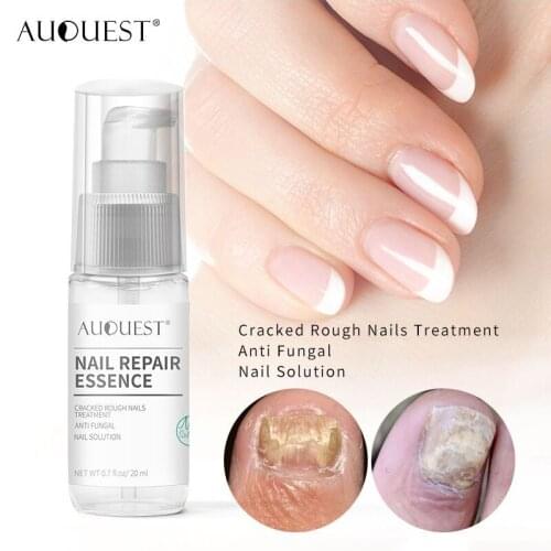 AUQUEST Nail Supplies Nourishing Moisturizing Anti-Barb Shining Nail Polish Soft Nail Exfoliating Nail Polish Skin Care Products
