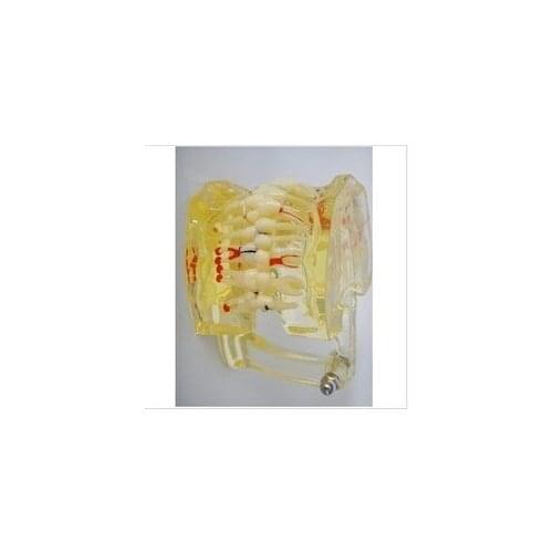 Free shipping Oral tooth pathology model Dental material