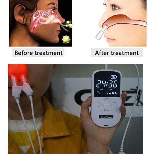 Nose Rhinitis Nose Massager Wire Hay Fever Low-Frequency Pulse Laser Rhinitis Therapy Device Laser Nose Massager