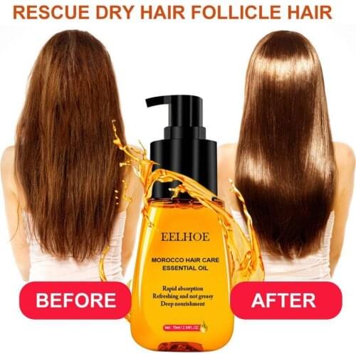 70ml Morocco Hair Care Essential Oil Fast Powerful Care Oil Increase Growth Prevent Hair Liquid Loss Essence Hair Hair Hair I8T9