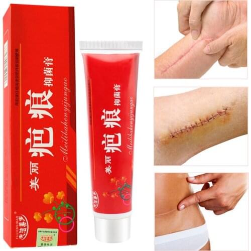 60g Scar Removal Cream for New Old Scars Acne Skin Repair Chinese Herbal Ointment Control Shrink Pores Moisturizer