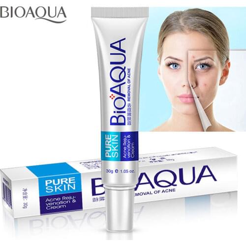 BIOAQUA Acne Removal Cream Gel Anti-Acne Scar Treatment Skin Care Face Whitening Cream Moisturizing Oil Control Acne Remover 30g