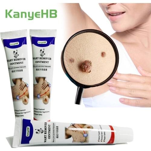 3pcs Warts Remover Ointment Wart Tag Corn Antibacterial Treatment Cream Genital Wart Papillomas Treatment Herbal Ointment A635