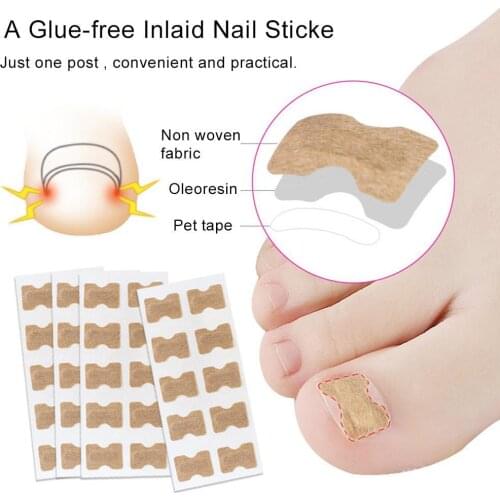 50Pcs Ingrown Toe Nail Correction Sticker Paronychia Foot Pedicure Corrector