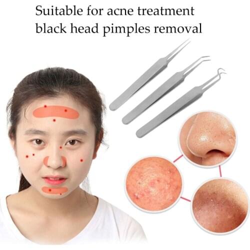 Practical Acne Needle Tweezers Blackhead Pimples Removal Pointed Bend Gib Head Face Care Tools health care message messager care