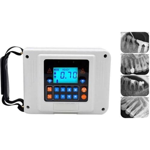 Led Medical Imaging Film Viewer Sensor Wireless Digital Portable X Ray Machine For Hospital