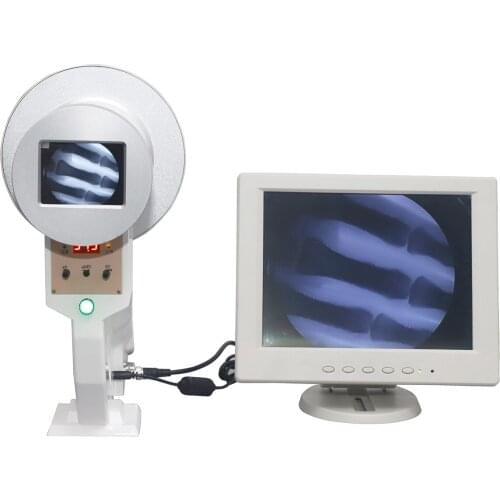 Portable X-Ray Equipment