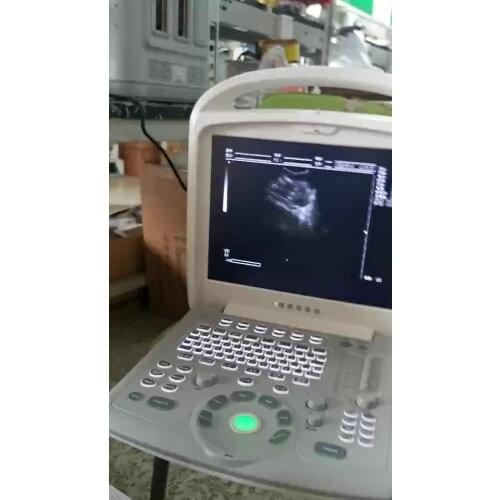 BELSE Ultrasound & Handheld Ultrasound Machine Price