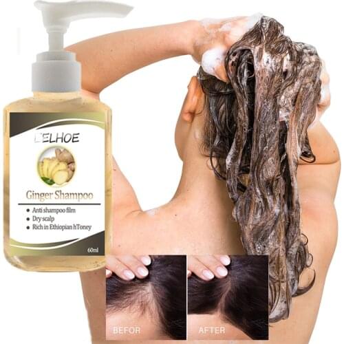 Ginseng Anti-Hair Loss Shampoo Powerful Treatment Essence Herbs Ginger Cooler Hair Growth Lotions for Men Women