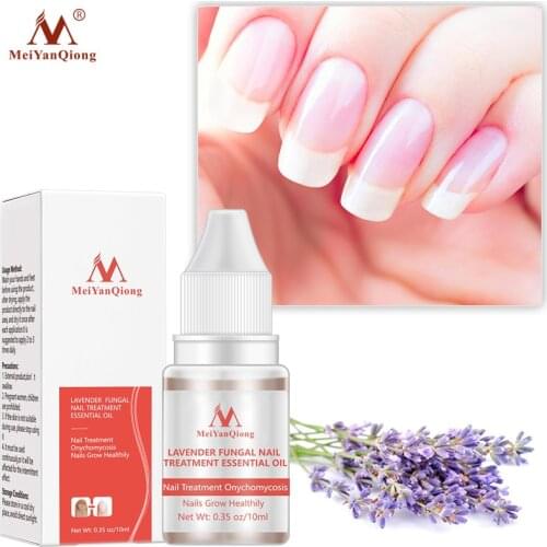 Fungal Nail Treatment Serum Onychomycosis Paronychia Anti-Fungal Nail Infection Herbal Toe Fungus Foot Repair Essence Care 10ml