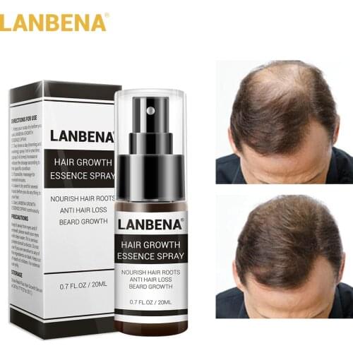 LANBENA Hair Growth Essence Spray Preventing Baldness Product Anti Hair Loss Nourish Repairing Roots Hair Care
