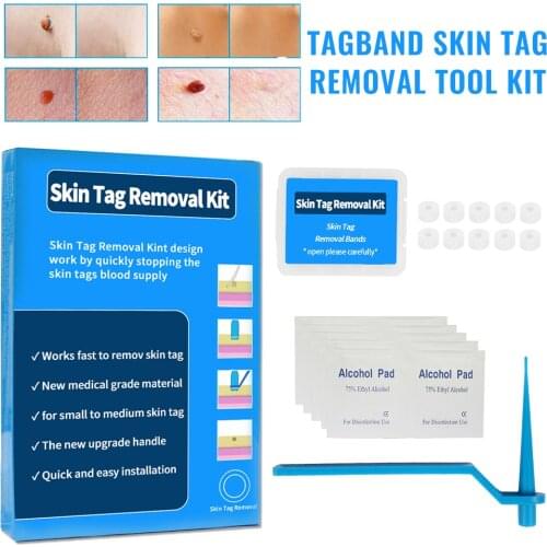 Skin Care Removal Meat Mole Removal Corn and Wart Skin Rubber Ring Skin Tag Skin Care Tool Facial Skin Care Tool