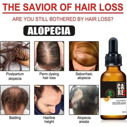 30ML Ginger Strong Hair Serum Consolidate Hair Roots Inhibite Scalp Oil Secretion Hair Growth Serum For Man And Women