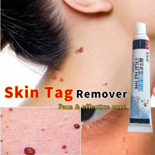 12 hours Wart Treatment Papillomas Removal of Warts Liquid From Skin Tags Removing Against Moles Remover Anti Verruca Remedy