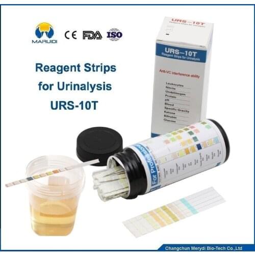 Urinalysis Reagent Leukocytes, Nitrite, Urobilinogen, Protein, pH,Blood, Specific Gravity, Ketone, Bilirubin, Glucose