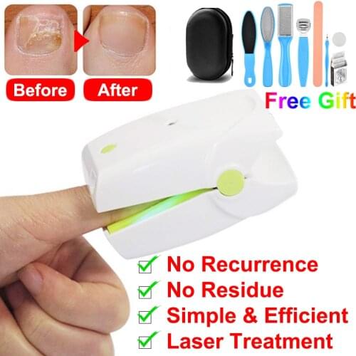 Sun Glory Foot Care Tools