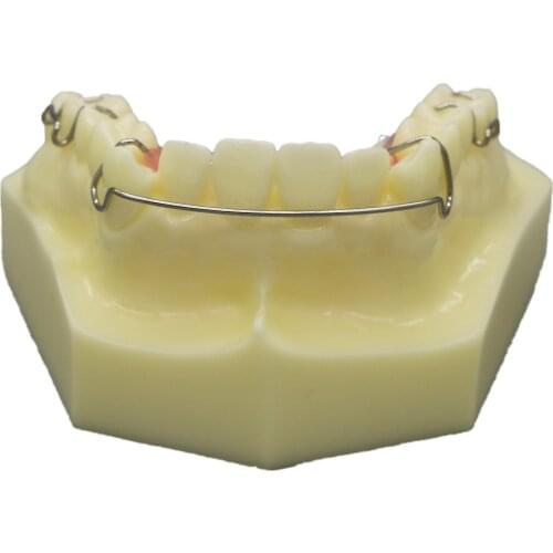 NEW Dental Model Hawley Retainer Model #3007 01