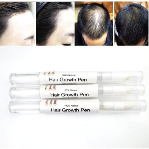 Natural faster Grow 5% mino Hair Growth regrowth oil tonic serum products rajout cheveux cure Products Stop Hair Loss treatment