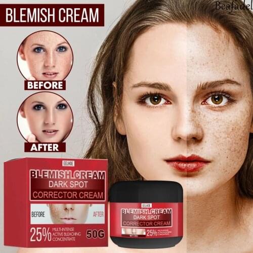50g Whitening Freckle Cream Remove Melasma Acne Spot Pigment Melanin Dark Spots Pigmentation Moisturizing Gel Skin Care TSLM1