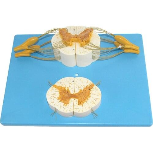 5 times Three dimensional morphology of spinal cord connecting spinal nerve in transverse section of spinal cord