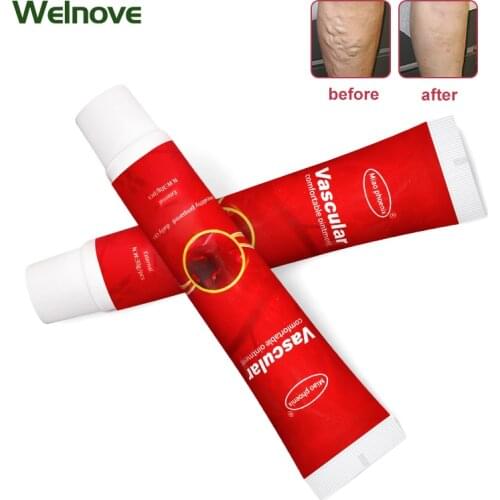 1Pcs 30g Varicose Veins Treatment Spider Vein Removal Cream Natural Treatment Relief Phlebitis Angiitis Oinment Pain Remedy