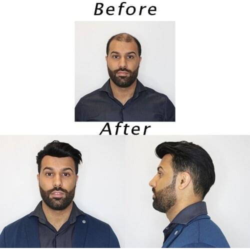 Men RemyToupee Hairpieces European Human Hair Replacement Hair Topper Pieces Burable Super Hairpieces Handmade with PU Base Size