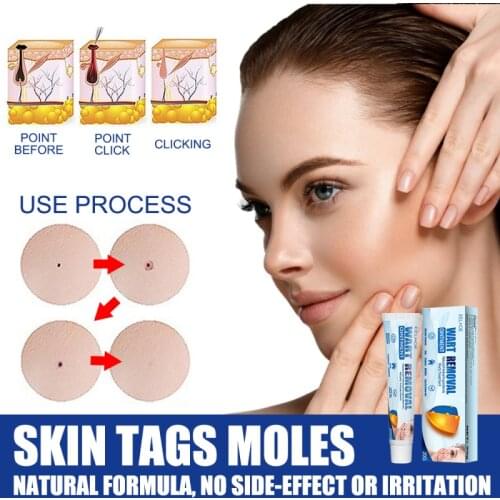 Warts Remover Antibacterial Ointment Wart Cream Skin Tag Remover Extract Corn Plaster Warts Ointment Body Skin Creams