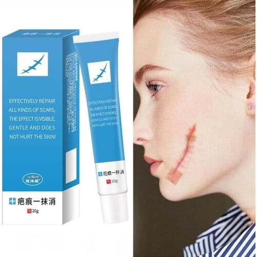 20g Scar Removal Cream Face Body Skin Repair Creams Health Care Acne Pots Scars Stretch Marks Remover Snake Ointment New Spot