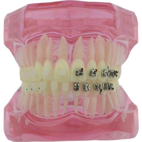 Dental Teeth Study Orthodontic Model with Metal and Ceramic Brackets 3003 Pink