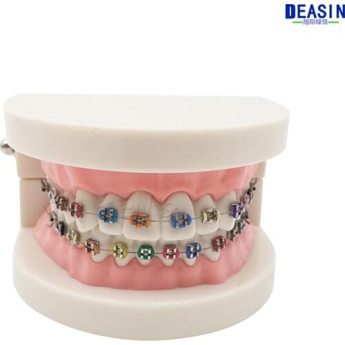 Good Quality 2016 Orthodontics Model for Dentist Dental 1/2 Standard Dentition with Full Metal Brackets Teeth Model