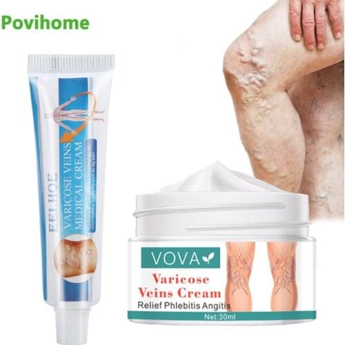 2Types Varicose Vein Ointment Phlebitis Vasculitis Treatment Cream Thigh Spider Remove Anti-swelling Pain Relief Medical Plaster