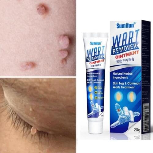1Pc Skin Tag Removal Warts Treatment Neck Face Foot Ointment Cream Warts Wart Removal Remover Medical Plaster Against Moles