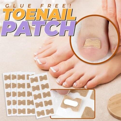 Glue-Free In-Grown Nail Patch Nail Corrector Positive Nail Strip Anti-roll Nail-free Nail Patch Pull Manicure Special Toenail