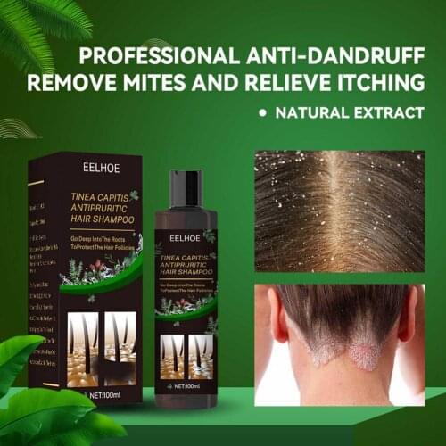 100ml Dandruff Medicated Shampoo Treatment Anti Dandruff Seborrheic Dermatitis Shampoo Relieve Flaking Itching Cools Scalp