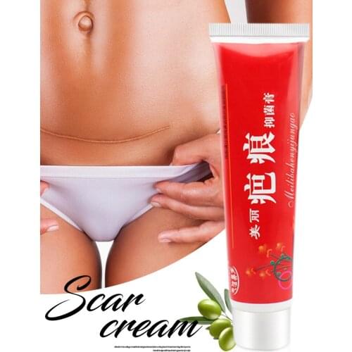 Acne Scar Removal gel Skin Stretch Marks Repair Anti Spots Acne Treatment Blackhead Whitening cream Shrink Pores Skin Care 60g