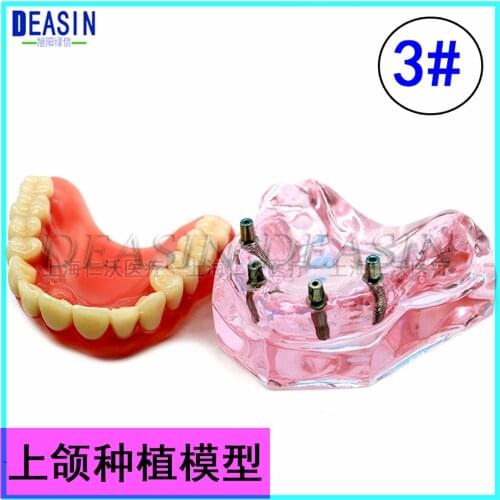 1 pc x high quality Resin Coverage dental implant model dentures Removable teeth model