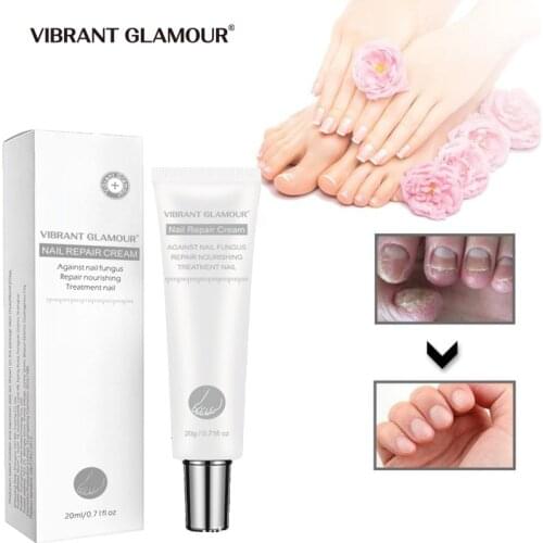 Nail Fungal Treatment Cream Foot Nail Fungus Removal Gel Onychomycosis Paronychia Anti-Fungal Nail Infection Toe Care Repair 20g