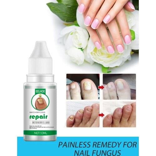 Eelhoe Onychomycosis Repair Liquid Nail Treatment Liquid Thicken Soft Nails Foot Antifungal Drugs Manicure Decoration TSLM2