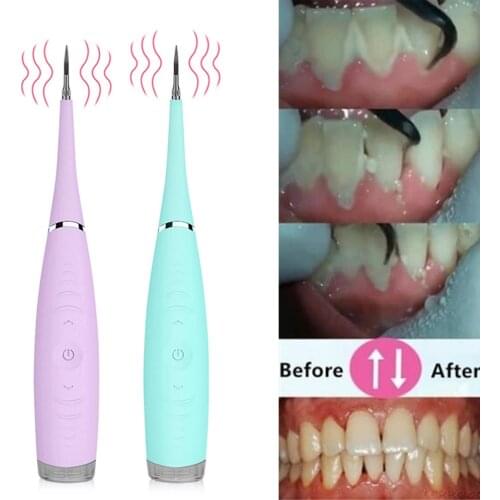 Portable Electric Sonic Dental Scaler Tooth Calculus Remover Tooth Stains Tartar Tool Dentist Teeth Whitening Oral Hygiene